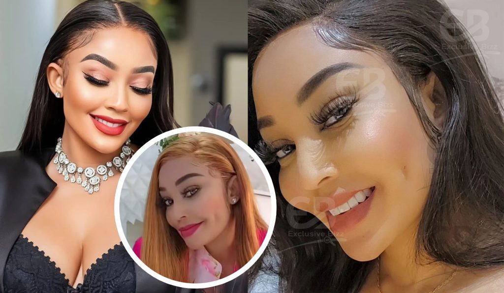 Zari Hassan Acquires Dimples After a Successful Plastic Surgery